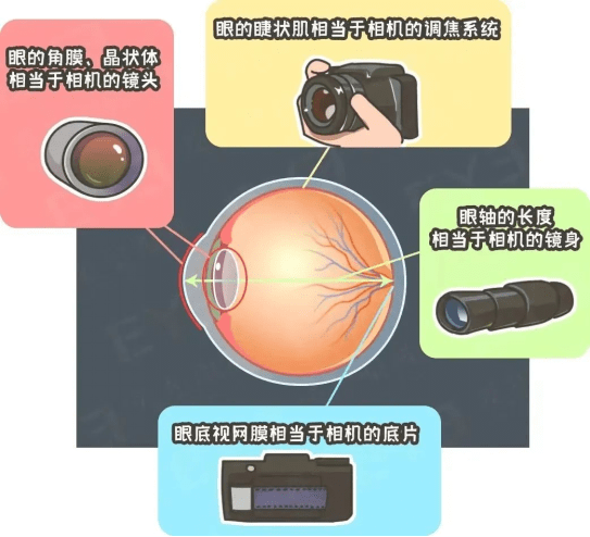 兰州爱尔眼科医院：近视手术后视力达到多少，手术才算成功(图4)