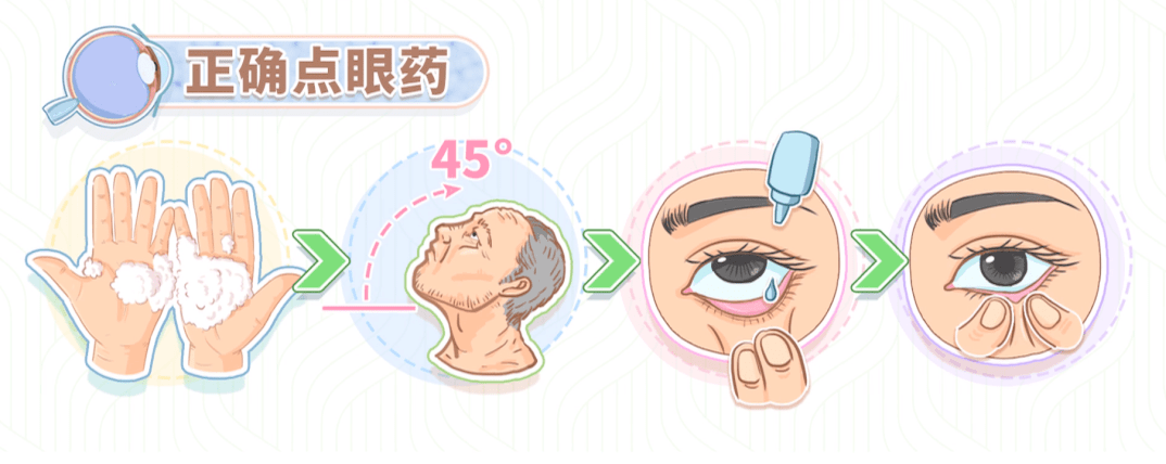兰州爱尔眼科医院：近视手术后视力达到多少，手术才算成功(图6)