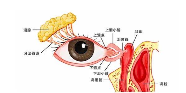 兰州爱尔眼科医院丨泪道阻塞有什么危害，怎么治疗？(图1)
