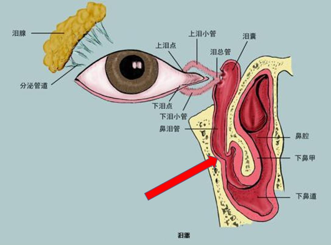 兰州爱尔眼科范好荣主任：迎风流泪，关于泪道堵塞你必须知道的那些事！ (图1)