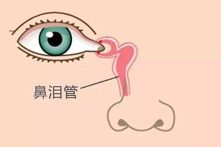 兰州爱尔眼科范好荣主任：迎风流泪，关于泪道堵塞你必须知道的那些事！ (图2)